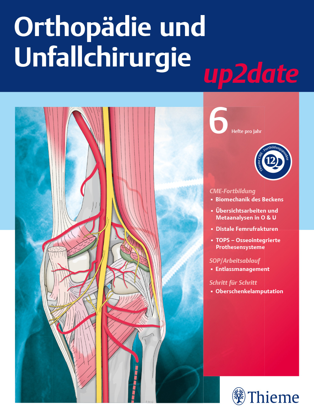 Orthopädie Und Unfallchirurgie Up2date - Georg Thieme Verlag