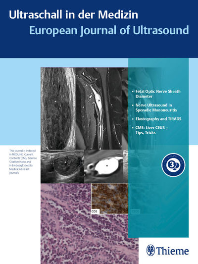 Ultraschall in der Medizin - European Journal of Ultrasound Cover